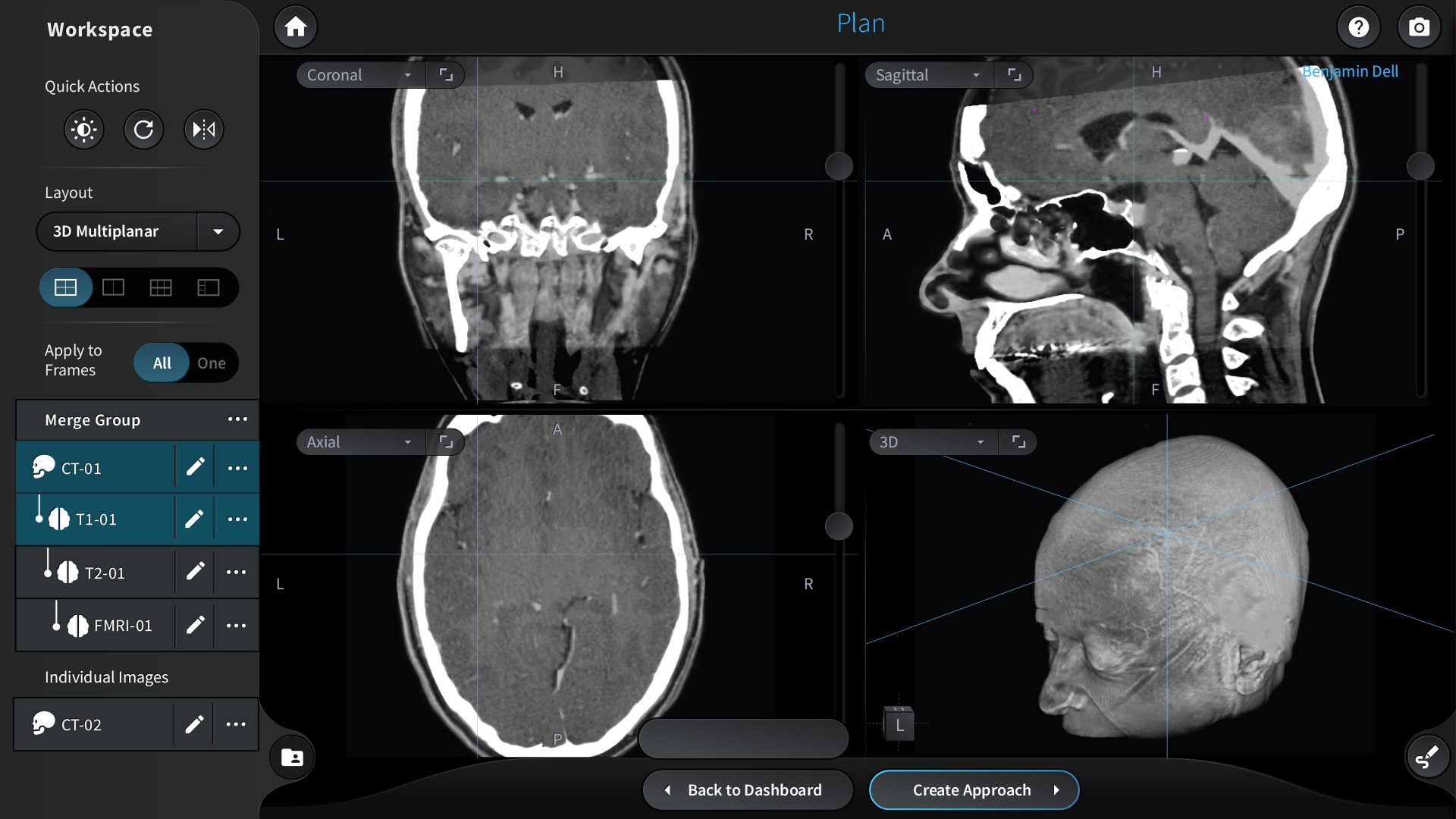 Cranial Map